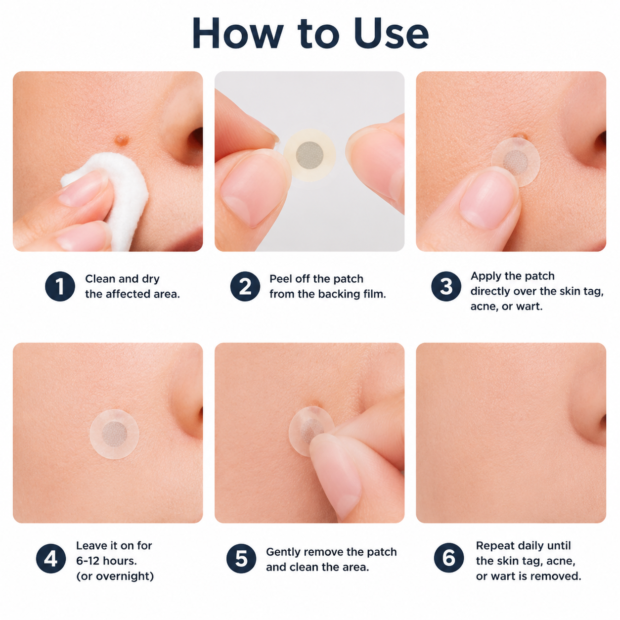 𝑮𝒂𝒇𝒂𝒄𝒆®2-in-1 Microneedle & Hydrocolloid Patch🍀| Removes Raised Moles, Acne, Flat Warts & Skin Tags | Helps Improve Wrinkles, Scars & Blemishes | Invisible Patches for Face & Body