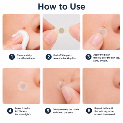 𝑮𝒂𝒇𝒂𝒄𝒆®2-in-1 Microneedle & Hydrocolloid Patch🍀| Removes Raised Moles, Acne, Flat Warts & Skin Tags | Helps Improve Wrinkles, Scars & Blemishes | Invisible Patches for Face & Body
