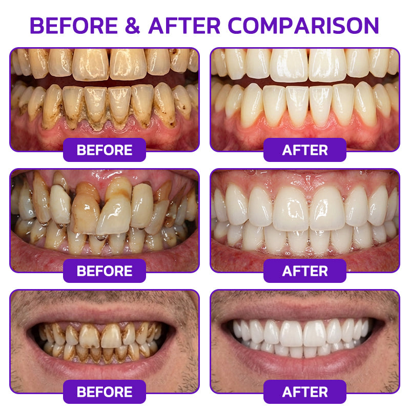 GLIMMERLY® VioCore Bee Venom Gingivitis & Periodontitis Treatment Toothpaste🎄📀