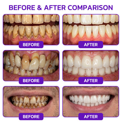 GLIMMERLY® VioCore Bee Venom Gingivitis & Periodontitis Treatment Toothpaste🎄📀