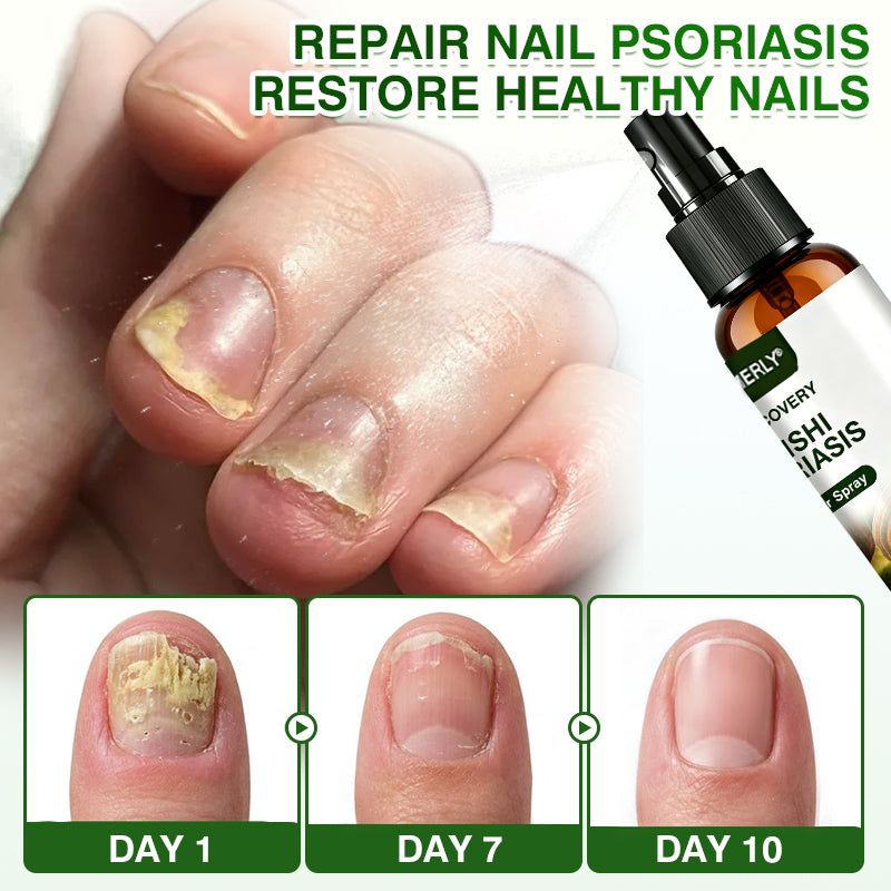 🛖💵GLIMMERLY® SkinRecovery Reishi Psoriasis Repair Spray