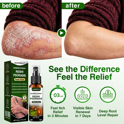 🛖💵GLIMMERLY® SkinRecovery Reishi Psoriasis Repair Spray