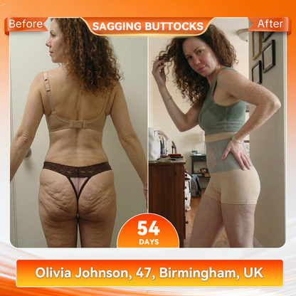 PAURAJU® 30-Min All-in-One Micro-Particle Fat-Burning Shorts✅Ignites deep microcirculation to melt fat, flush toxins, and reverse metabolic aging.