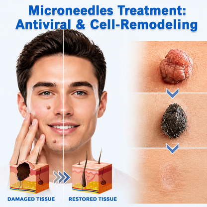 𝑮𝒂𝒇𝒂𝒄𝒆®2-in-1 Microneedle & Hydrocolloid Patch🍀| Removes Raised Moles, Acne, Flat Warts & Skin Tags | Helps Improve Wrinkles, Scars & Blemishes | Invisible Patches for Face & Body