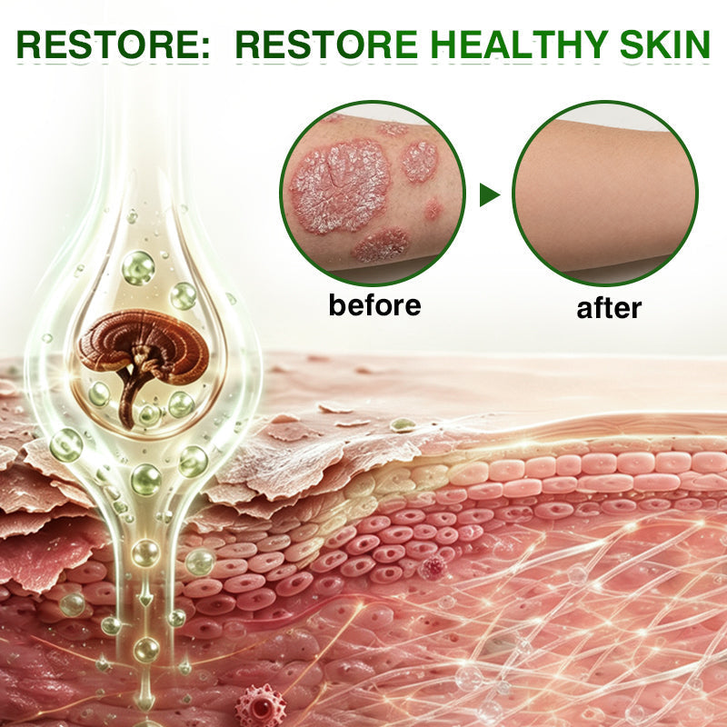 🛖💵GLIMMERLY® SkinRecovery Reishi Psoriasis Repair Spray