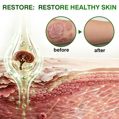 🛖💵GLIMMERLY® SkinRecovery Reishi Psoriasis Repair Spray