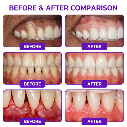 GLIMMERLY® VioCore Bee Venom Gingivitis & Periodontitis Treatment Toothpaste🎄📀