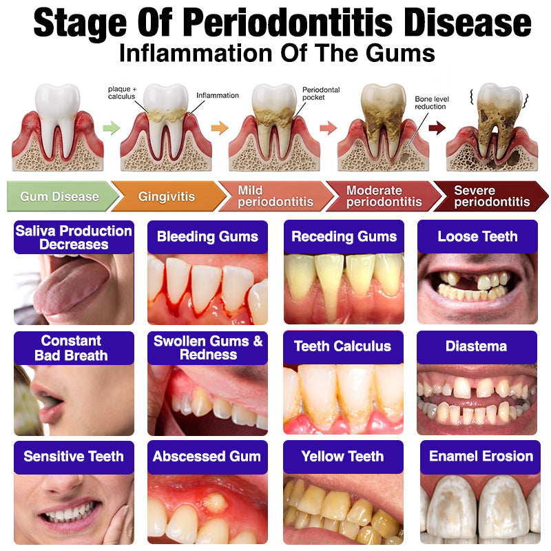 GLIMMERLY® VioCore Bee Venom Gingivitis & Periodontitis Treatment Toothpaste🎄📀